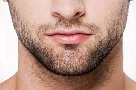 Mersin Saç Ekim - sakal-ekimi-tedavisi