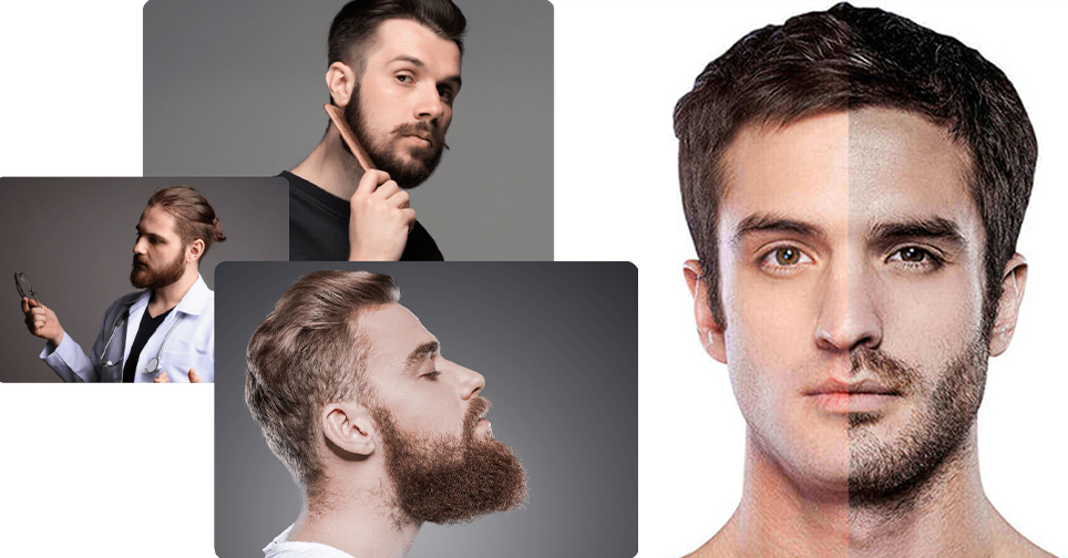 Mersin Saç Ekim - sakal-ekimi